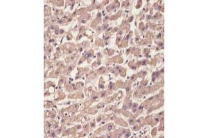 (ABIN652227 and ABIN2840949) staining TTR in human liver tissue sections by Immunohistochemistry (IHC-P - paraformaldehyde-fixed, paraffin-embedded sections). (TTR anticorps  (C-Term))
