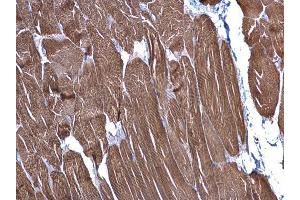 IHC-P Image alpha Cardiac Muscle Actin antibody detects alpha Cardiac Muscle Actin protein at cytoplasm on mouse muscle by immunohistochemical analysis.
