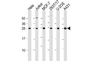All lanes : Anti-RPL14 Antibody (Center) at 1:2000 dilution Lane 1: Hela whole cell lysate Lane 2: Jurkat whole cell lysate Lane 3: MCF-7 whole cell lysate Lane 4: 293T/17 whole cell lysate Lane 5: U-2OS whole cell lysate Lane 6: A431 whole cell lysate Lysates/proteins at 20 μg per lane. (RPL14 anticorps  (AA 117-147))