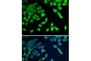 Immunofluorescence analysis of A-549 cells using WDR77 Polyclonal Antibody (WDR77 anticorps)