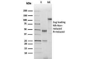 SDS-PAGE Analysis of Purified NKX2.