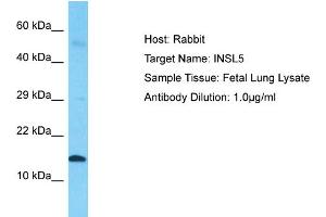 Host: Rabbit  Target Name: INSL5  Sample Tissue: Fetal Lung lysates  Antibody Dilution: 1.
