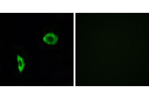 Immunofluorescence analysis of LOVO cells, using Prostacyclin Receptor antibody. (Prostacyclin Receptor anticorps)
