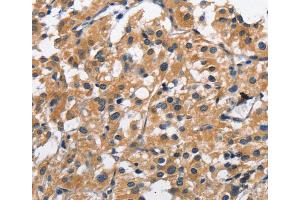 Immunohistochemistry (IHC) image for anti-C-Type Lectin Domain Family 2, Member D (CLEC2D) antibody (ABIN2824426) (CLEC2D anticorps)