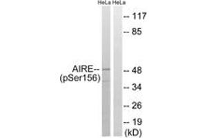 Western blot analysis of extracts from HeLa cells treated with Hu 2nM 24h, using AIRE (Phospho-Ser156) Antibody. (AIRE anticorps  (pSer156))