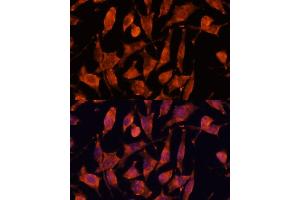 Immunofluorescence analysis of L929 cells using XPNPEP3 antibody  at dilution of 1:100.