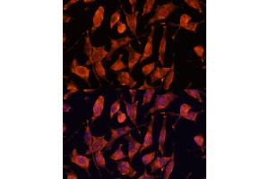 Immunofluorescence analysis of L929 cells using XPNPEP3 antibody  at dilution of 1:100. (XPNPEP3 anticorps  (AA 1-250))