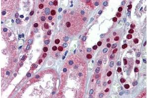 Human Kidney: Formalin-Fixed, Paraffin-Embedded (FFPE)