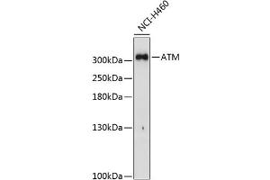 Western blot analysis of extracts of H460 cells, using ATM Antibody (ABIN6133566, ABIN6137281, ABIN6137282 and ABIN6221615) at 1:1000 dilution. (ATM anticorps  (AA 1900-2000))