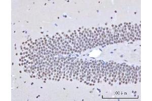 IHC analysis of RBM22 using anti-RBM22 antibody (ABIN7600268). (RBM22 anticorps  (AA 17-406))