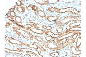 Formalin-fixed, paraffin-embedded human kidney stained with Aurora B Recombinant Mouse Monoclonal Antibody (rAURKB/1592). (Recombinant Aurora Kinase B anticorps  (AA 89-251))