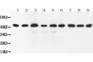 Western Blotting (WB) image for anti-SRY (Sex Determining Region Y)-Box 7 (SOX7) (AA 370-388), (C-Term) antibody (ABIN3042550) (SOX7 anticorps  (C-Term))