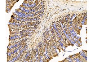 ABIN7094744 and ABIN7098795 at 1/100 staining Rat colorectal tissue by IHC-P.