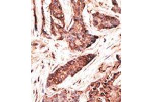 Image no. 2 for anti-2'-5'-Oligoadenylate Synthetase-Like (OASL) (C-Term) antibody (ABIN358720) (OASL anticorps  (C-Term))