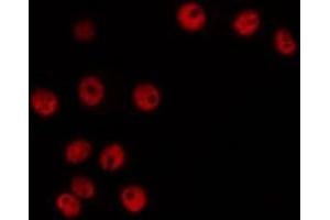 ABIN6266480 staining HeLa by IF/ICC.