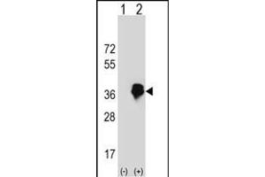 Western blot analysis of MLX (arrow) using rabbit polyclonal MLX Antibody (Center) (ABIN652578 and ABIN2842390). (MLX anticorps  (AA 125-151))