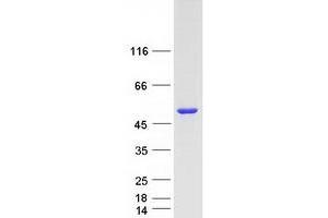 Validation with Western Blot