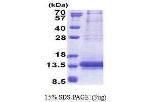 SDS-PAGE (SDS) image for NADH Dehydrogenase (Ubiquinone) Flavoprotein 3, 10kDa (NDUFV3) (AA 35-108) protein (His tag) (ABIN5853263) (NDUFV3 Protein (AA 35-108) (His tag))