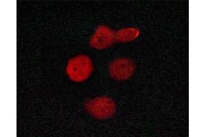 ABIN6267655 staining HeLa cells by ICC/IF. (MED1 anticorps  (pThr1457))
