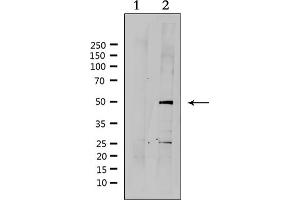 Western blot analysis of extracts from HepG2, using SUV39H2 Antibody. (SUV39H2 anticorps  (Internal Region))