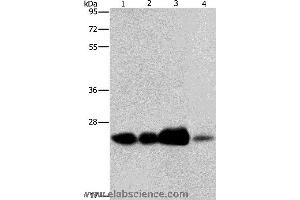 Western blot analysis of 293T cell and human fetal liver tissue, human cervical cancer and fetal muscle tissue, using ARFRP1 Polyclonal Antibody at dilution of 1:800 (ARFRP1 anticorps)