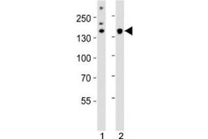 Western blot analysis of lysate from 1) HeLa cell line and 2) mouse cerebellum tissue using Kdm6b antibody at 1:1000. (Kdm6b anticorps  (AA 1023-1057))