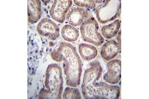 Formalin fixed, paraffin embedded human kidney tissue stained with SP140 Antibody   followed by peroxidase conjugation of the secondary antibody and DAB staining.