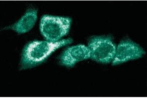 Immunofluorescent staining of Hs 766T cells. (RPS6KA1 anticorps  (AA 1-184))