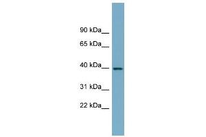 WB Suggested Anti-SULT2B1 Antibody Titration:  0. (SULT2B1 anticorps  (N-Term))