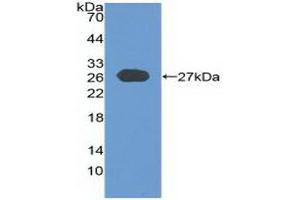 Detection of Recombinant CYLD, Human using Polyclonal Antibody to Cylindromatosis (CYLD) (CYLD anticorps  (AA 170-338))