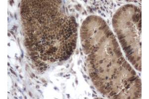 Image no. 1 for anti-Zinc Finger, Imprinted 2 (ZIM2) (AA 1-150), (AA 428-527) antibody (ABIN1490591)