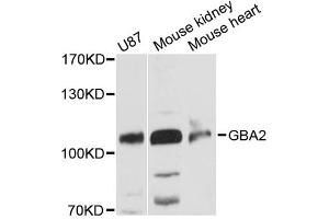 Western blot analysis of extracts of various cell lines, using GBA2 antibody (ABIN6292695) at 1:3000 dilution.
