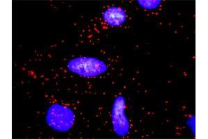 Proximity Ligation Analysis of protein-protein interactions between CCND2 and CDKN1A.