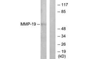 Western blot analysis of extracts from HuvEc cells, using MMP-19 Antibody. (MMP19 anticorps  (AA 11-60))