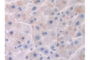 IHC-P analysis of Human Liver Tissue, with DAB staining. (OTUB1 anticorps  (AA 1-271))