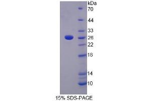 SDS-PAGE analysis of Human LRP3 Protein. (LRP3 Protéine)