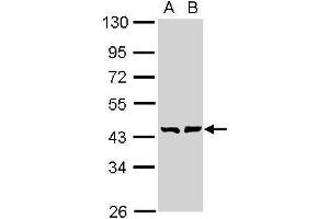 WB Image Sample (30 ug of whole cell lysate) A: A431 , B: H1299 10% SDS PAGE antibody diluted at 1:1000 (GMDS anticorps)