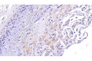 Detection of PDLIM1 in Human Placenta Tissue using Polyclonal Antibody to PDZ And LIM Domain Protein 1 (PDLIM1) (PDLIM1 anticorps  (AA 2-329))