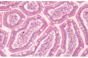 Human Small Intestine: Formalin-Fixed, Paraffin-Embedded (FFPE)