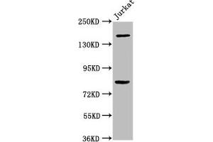 Western Blot Positive WB detected in: Jurkat whole cell lysate All lanes: BCL9 antibody at 3. (BCL9 anticorps  (AA 231-340))