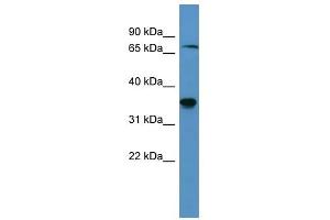 Western Blot showing SH3BP5 antibody used at a concentration of 1-2 ug/ml to detect its target protein. (SH3BP5 anticorps  (C-Term))
