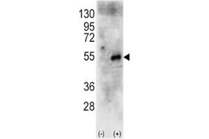 Western blot analysis of p70S6Kb antibody and 293 cell lysate (2 ug/lane) either nontransfected (Lane 1) or transiently transfected with the human RPS6KB2 gene (2).