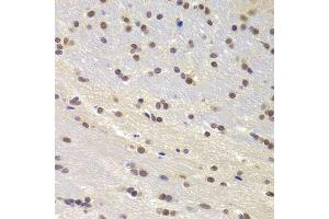 Immunohistochemistry of paraffin-embedded rat brain using PRPF3 Antibody. (PRPF3 anticorps  (AA 1-280))