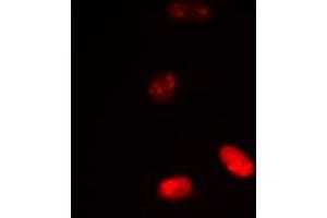 Immunofluorescent analysis of Histone H3 (AcK18) staining in HeLa cells.