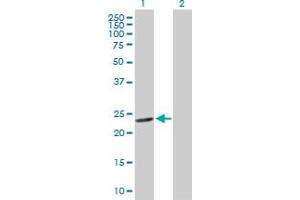 Western Blot analysis of GSTM4 expression in transfected 293T cell line by GSTM4 MaxPab polyclonal antibody. (GSTM4 anticorps  (AA 1-218))