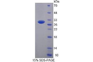 SDS-PAGE analysis of Human UBE2S Protein.