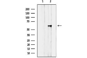 anti-Cytochrome P450 2A6V2 (C-Term) antibody