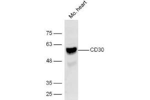 Lane 1: Mouse heart lysates probed with Rabbit Anti-CD30 Polyclonal Antibody, Unconjugated (ABIN1385704) at 1:300 overnight at 4˚C.