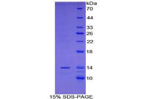 SDS-PAGE analysis of Mouse R-Spondin 1 Protein.