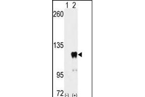 PUM2 anticorps  (AA 159-189)